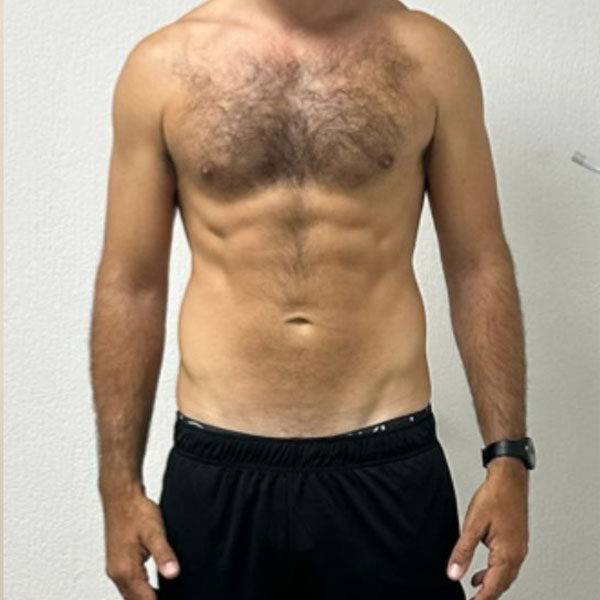 After Transformation 1