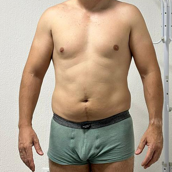 After Transformation 2