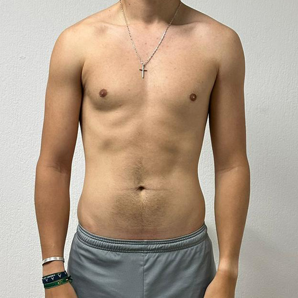 After Transformation 3