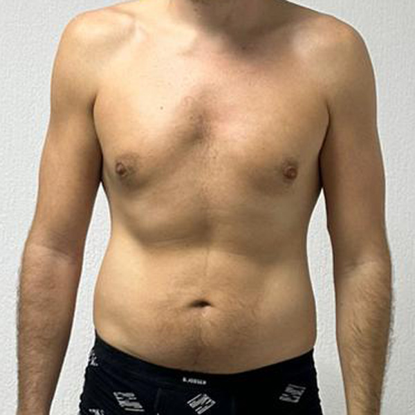 After Transformation 4