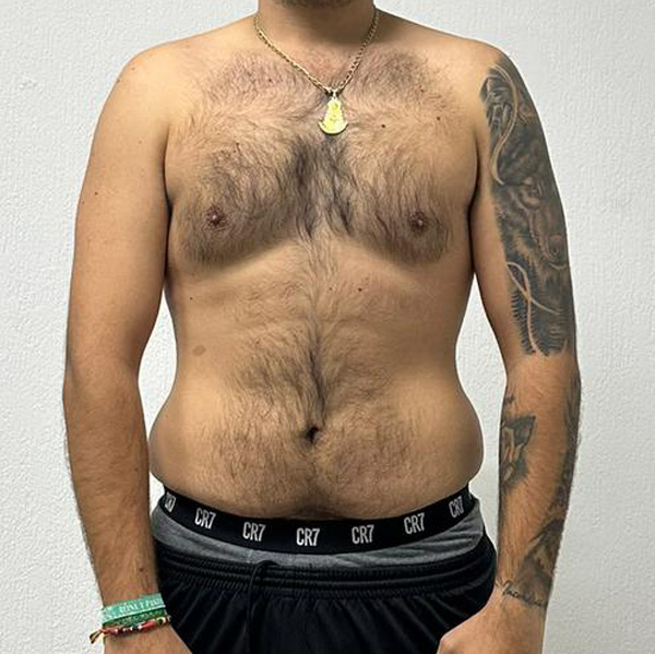 After Transformation 5