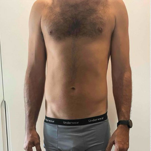 Before Transformation 1