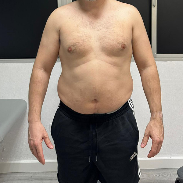 Before Transformation 2