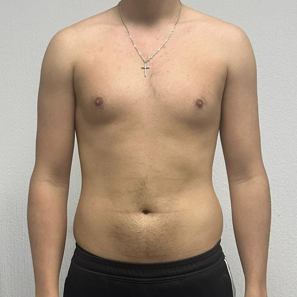 Before Transformation 3