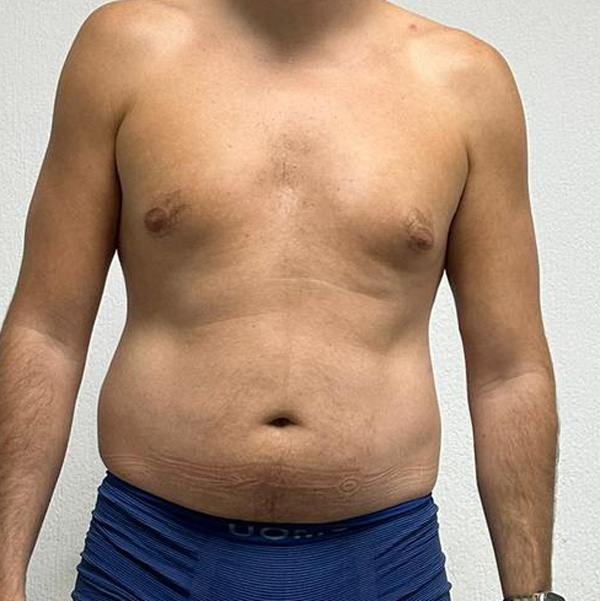 Before Transformation 4