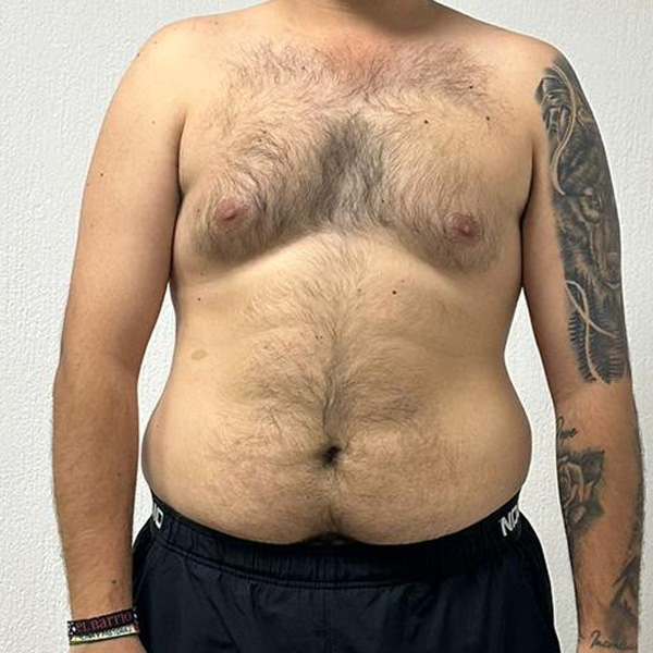 Before Transformation 5