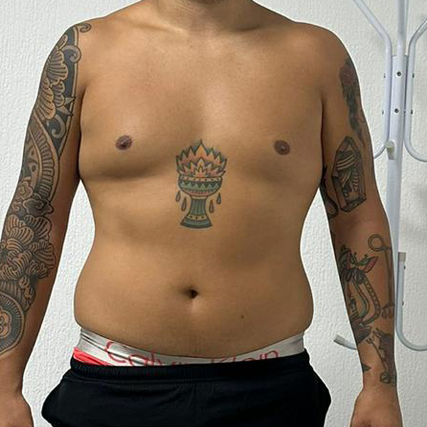 Before Transformation 6